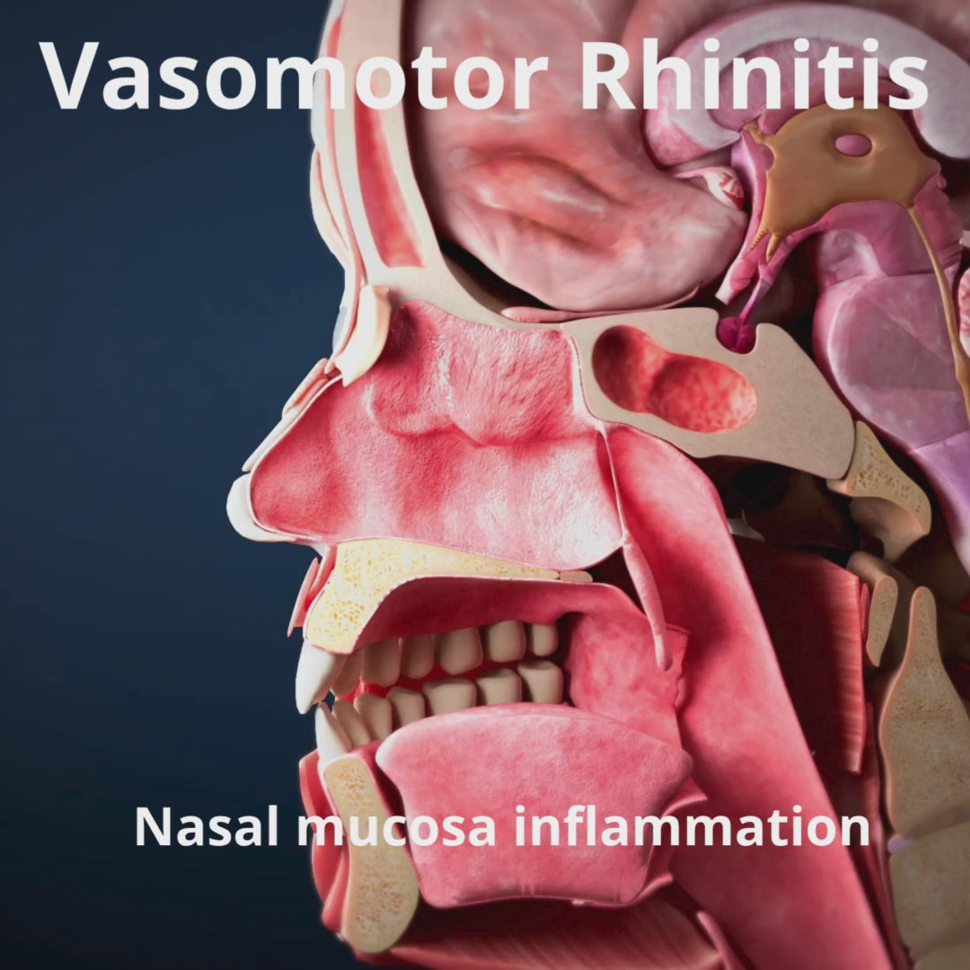 Load video: Celmast Nasal Spray - Children